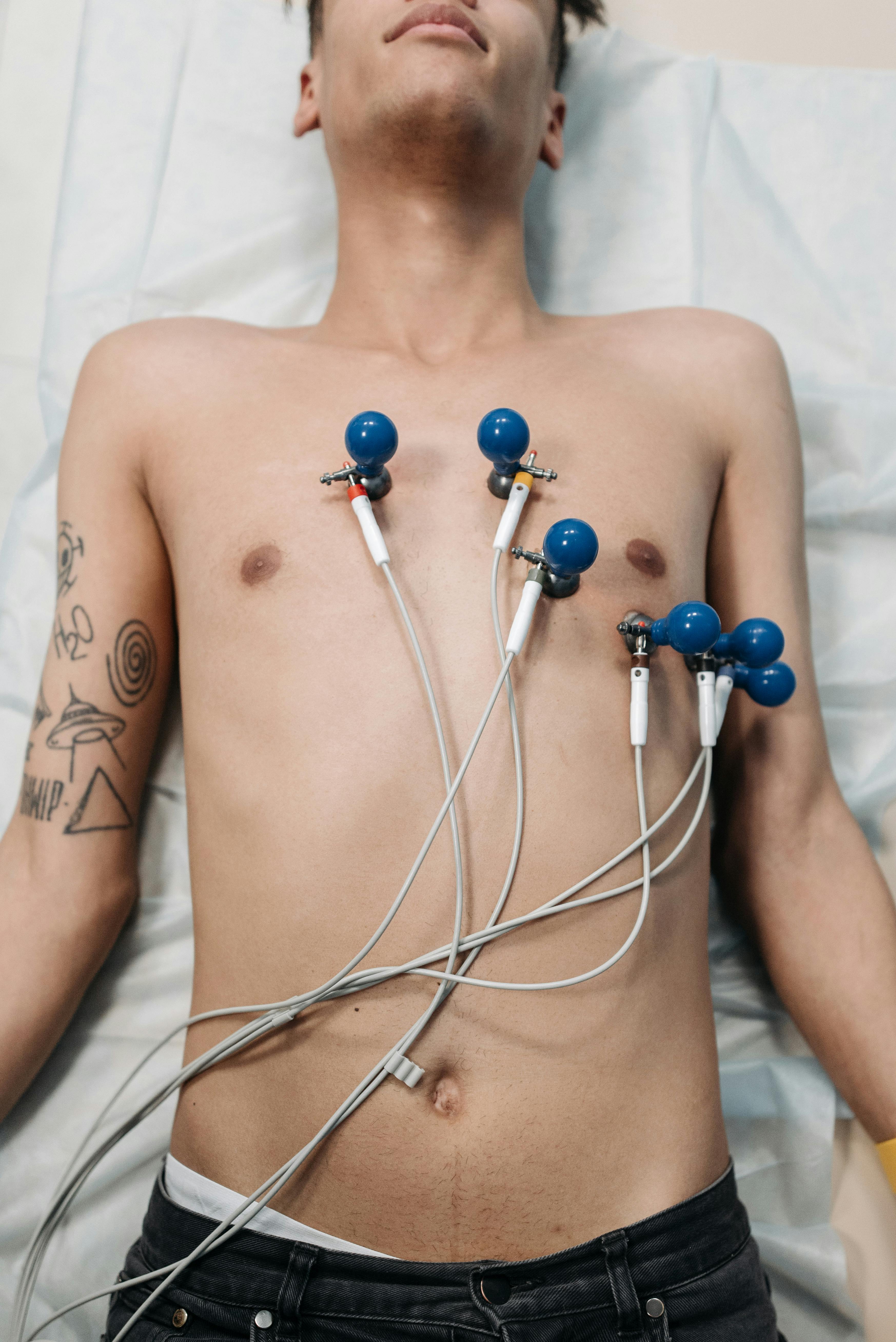 ECG Services